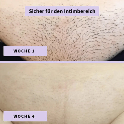 Elvua Haarwuchshemmendes Serum